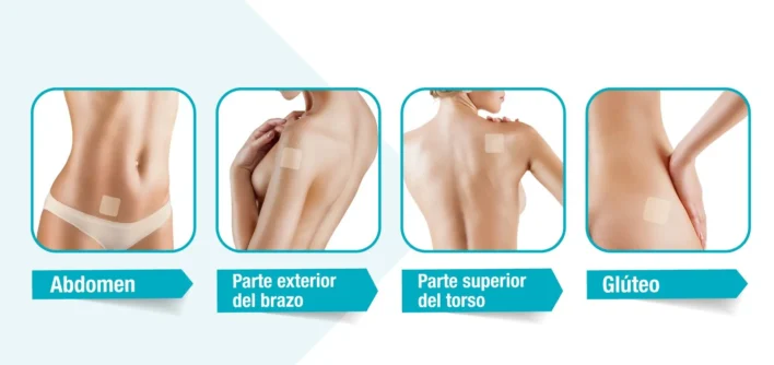 -Donde+colocar+el+parche+anticonceptivo--1920w